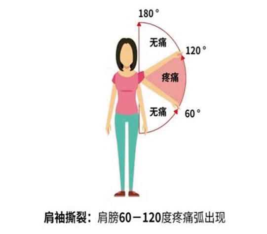 肩痛就是肩周炎？怎么分辨是不是肩周炎？