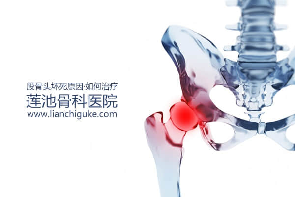 股骨頭壞死原因？如何治療股骨頭壞死？