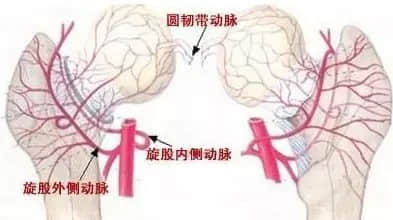 股骨頭壞死和腎虛是否有關(guān)系？