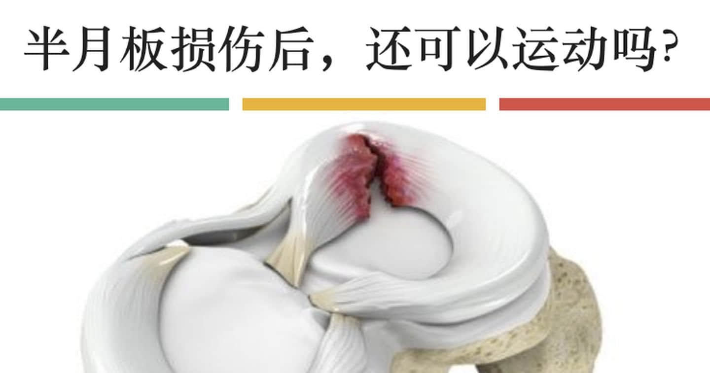 半月板損傷如何發(fā)生？半月板損傷多久能恢復(fù)