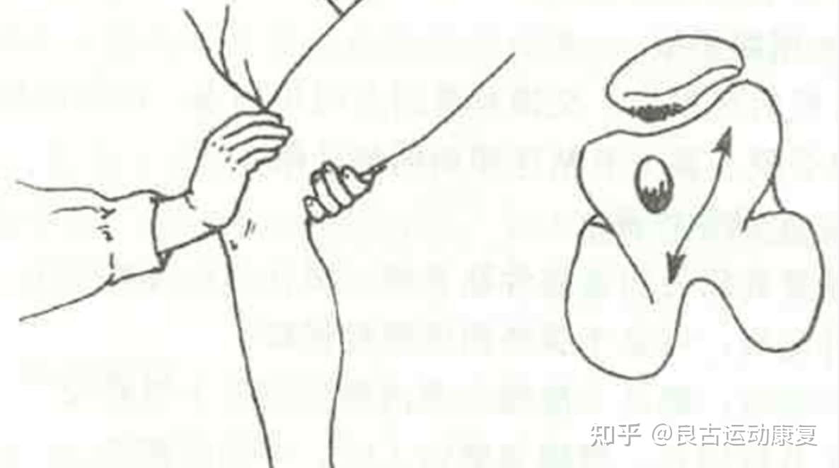 這個(gè)膝痛是最常見的運(yùn)動(dòng)損傷，如何自我康復(fù)？