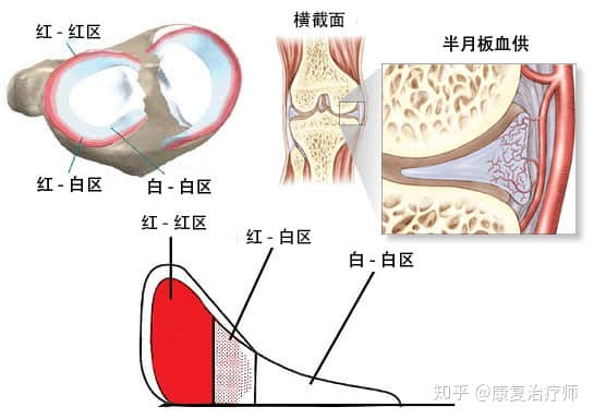 半月板損傷了，選擇修復還是切除？