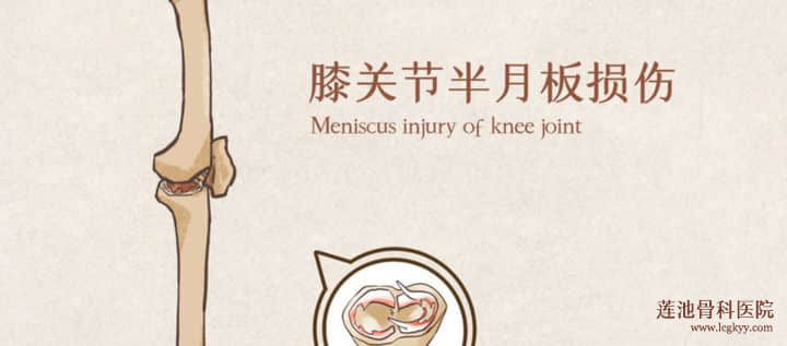 關(guān)節(jié)鏡手術(shù)的體驗(yàn)如何？